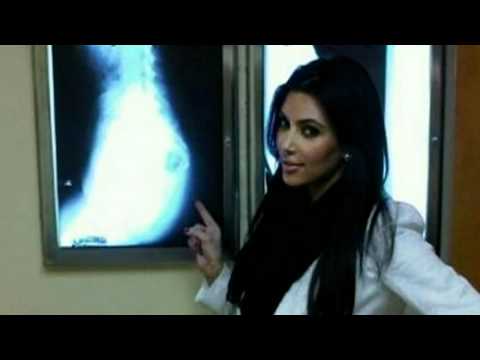 Kim Kardashian X-rays bottom